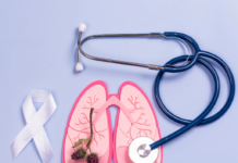 Lung Cancer Prevention